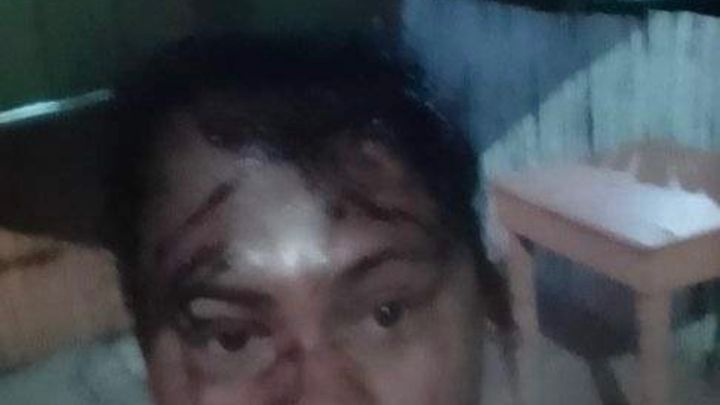 Foto de la recaudación de fondos Ayuda a Arcenia a estar a salvo , 1 de 5