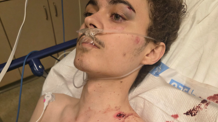 Help My Son Recover After Violent Robbery campaign photo, 1 of 6