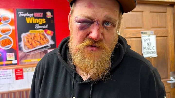 Support Larry’s Recovery After the Attack campaign photo, 1 of 5