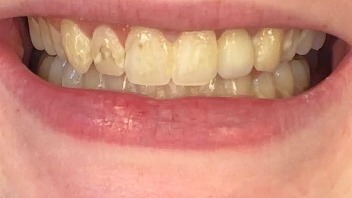 Support for My Dental Health Journey