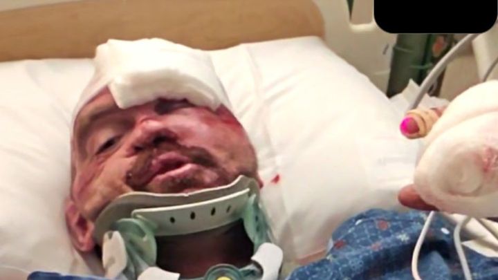 Support Lance After Hit and Run campaign photo, 1 of 5