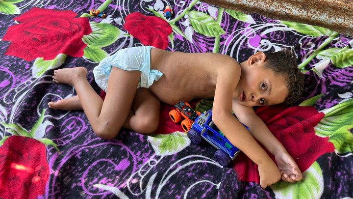 Urgent Support Needed for Germán's Spine Cancer Treatment campaign photo, 1 of 3