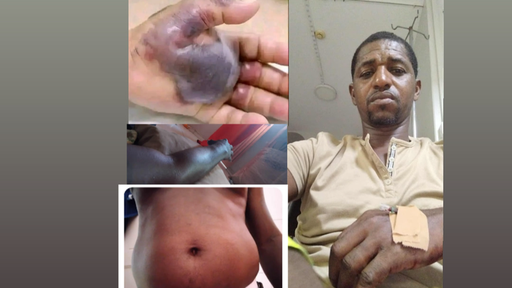 Help Eusébio Moreno's Heart Tumor Treatment campaign photo, 1 of 5