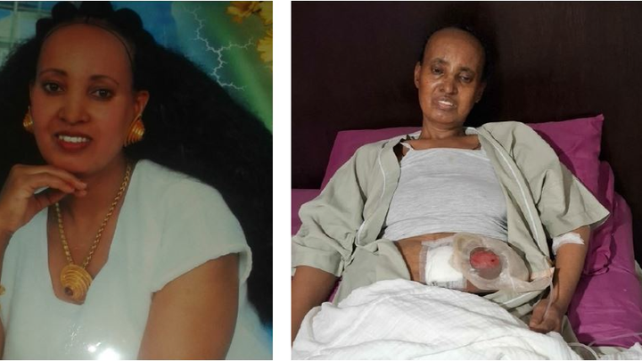 Urgent Appeal: Save an Eritrean Mother Battling Cancer campaign photo, 1 of 6