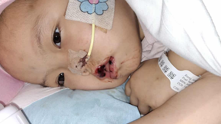 3 years Alina Xiong loses battle with cancer campaign photo, 1 of 8
