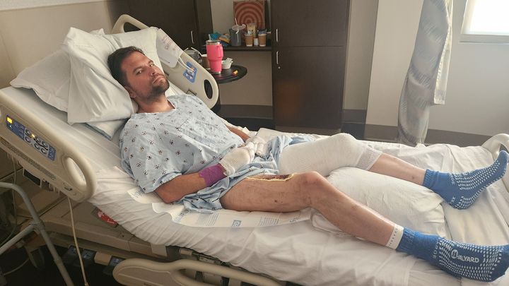 Help Victor Recover After a Portable Charger Explosion campaign photo, 1 of 5