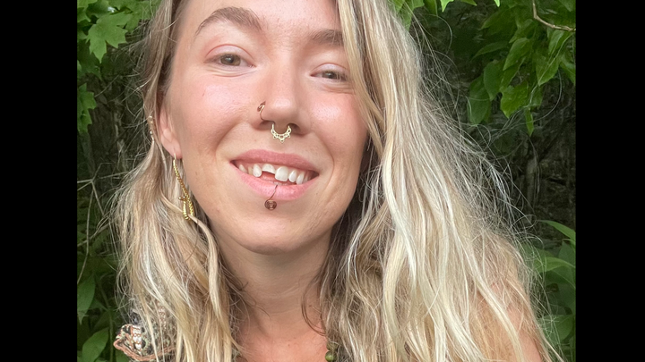 Help save Joanna’s smile campaign photo, 1 of 3
