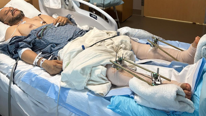 Help Alberto Recover After a Life-Changing Accident campaign photo, 1 of 4