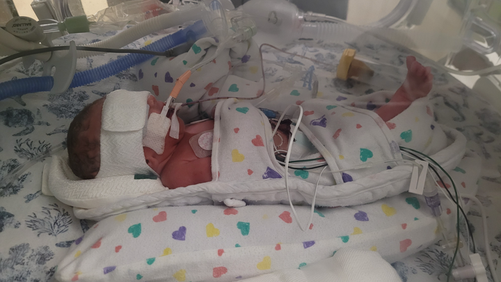Help For Baby Jaxson campaign photo, 1 of 5
