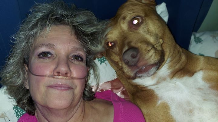 Support for My Lung Transplant Journey campaign photo, 1 of 3