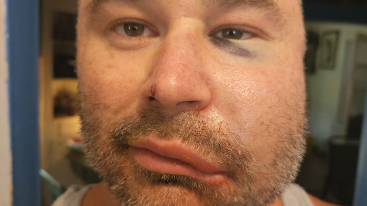 Photo for Help Shawn with medical recovery
