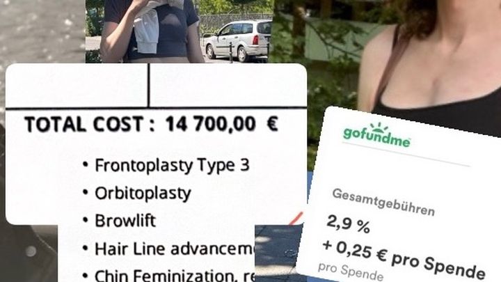Kampagnen-Foto für GESICHTSFEMINISIERUNG FÜR LENI, 1 von 3