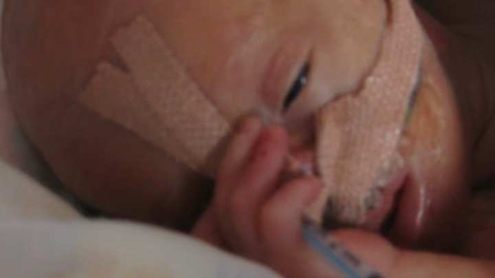 Kampagnen-Foto für Ein Leben voller Hoffnung – Hilfe für kleine Kämpfer, 1 von 7