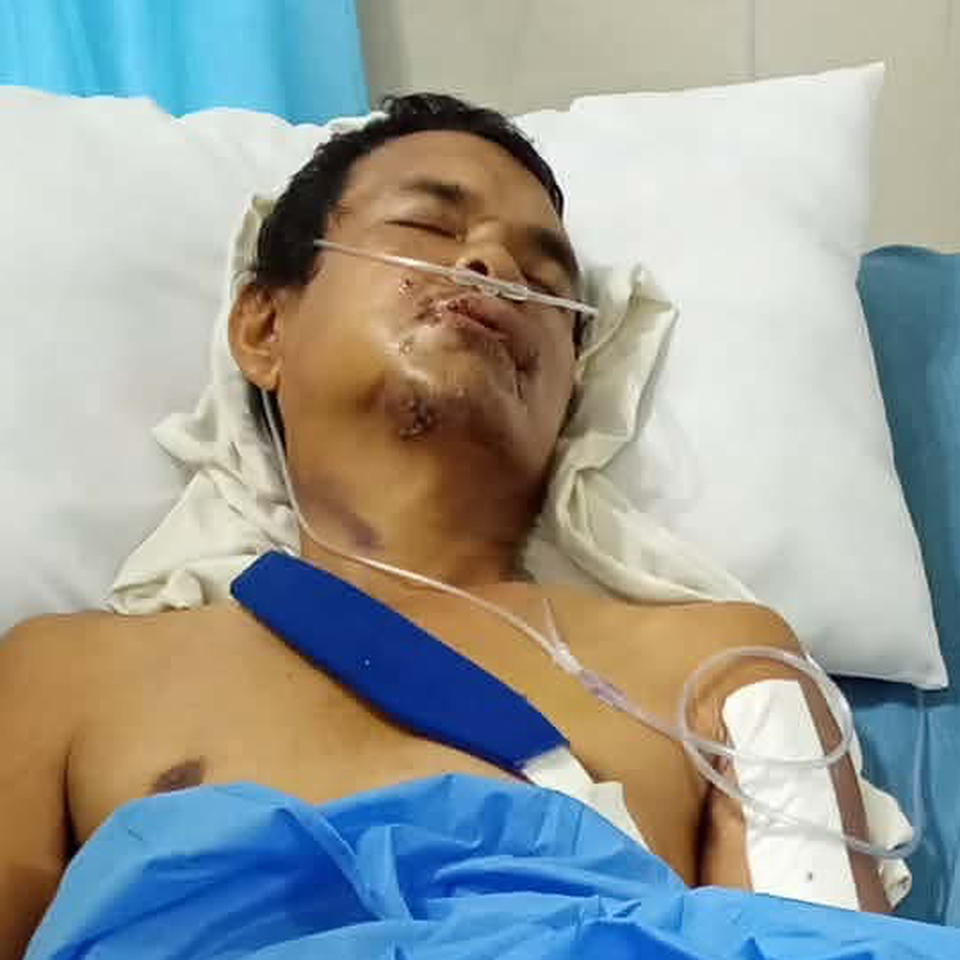Tragic accident need financial