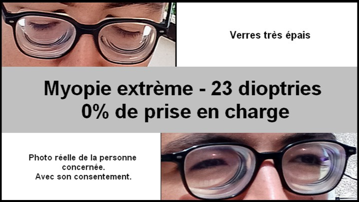 Aidez un jeune à financer sa chirurgie pour myopie sévère campaign photo, 1 of 5