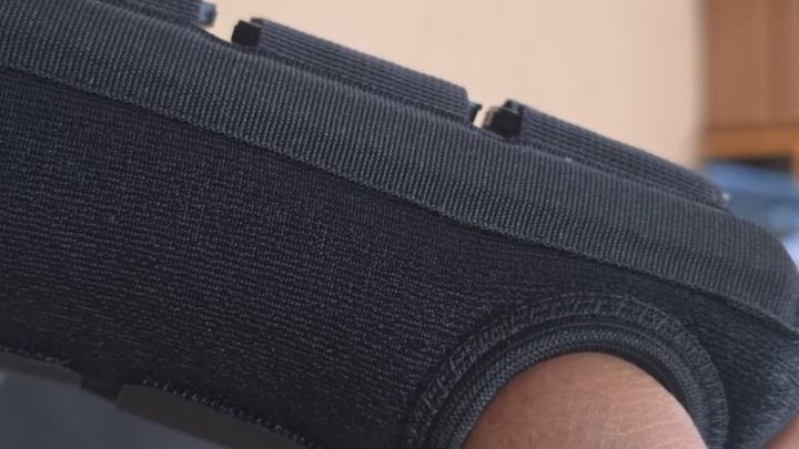 Help Gladys Get Treatment for Her Broken Wrist campaign photo, 1 of 4