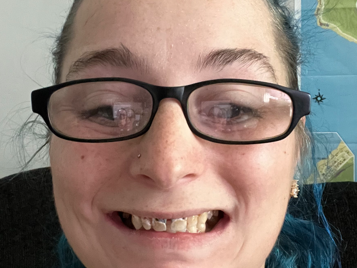 Fundraiser by Kayla Smith : Support Kayla Smiths Urgent Dental Treatment