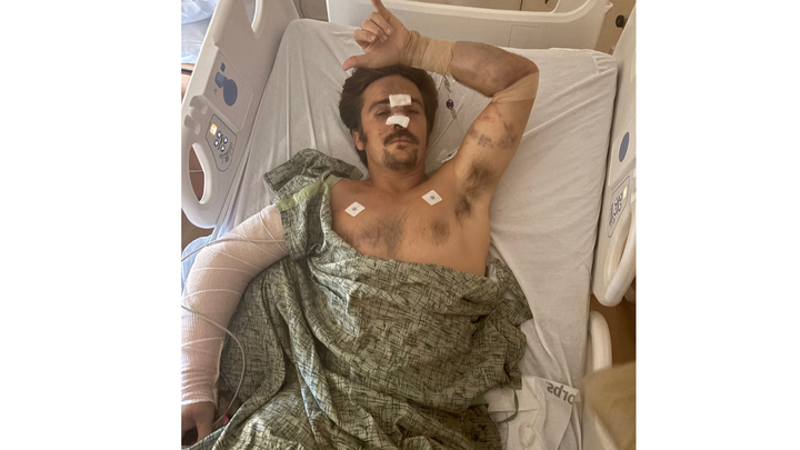Brysons road to recovery campaign photo, 1 of 5