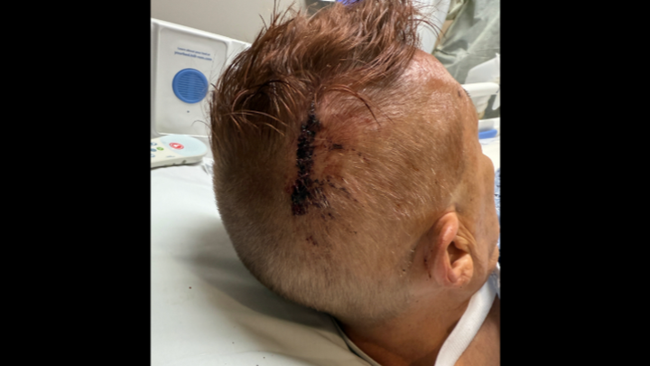 Help David to Heal from Multiple Gunshots campaign photo, 1 of 4