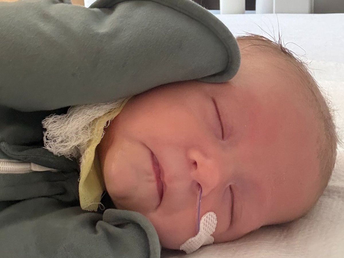 Support Rowan’s Recovery After Burn Accident campaign photo, 1 of 4