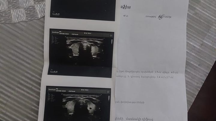 Support Needed for Life-Saving Brain Surgery campaign photo, 1 of 8