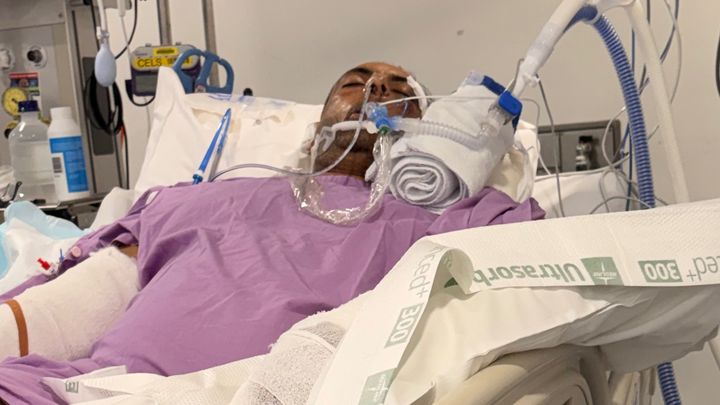Help Ajay Malik Recover After a Horrific Dog Attack campaign photo, 1 of 3