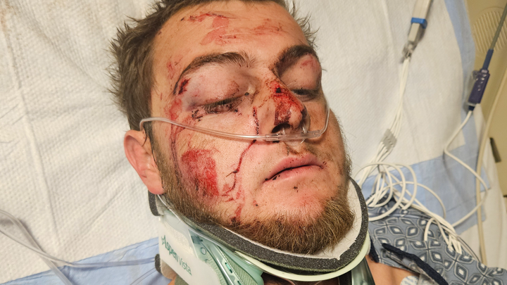 Donate to Justin's Long Road to Recovery campaign photo, 1 of 3