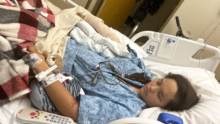 Help Alexa Recover After Bike Accident campaign photo, 1 of 4