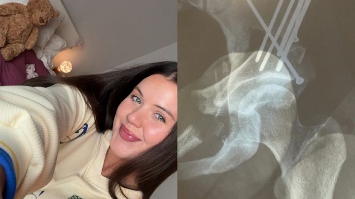 Helping our girl Soph heal campaign photo, 1 of 4