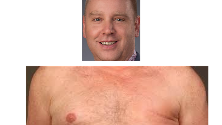 fundraiser-by-phillip-rabe-nick-s-nipple