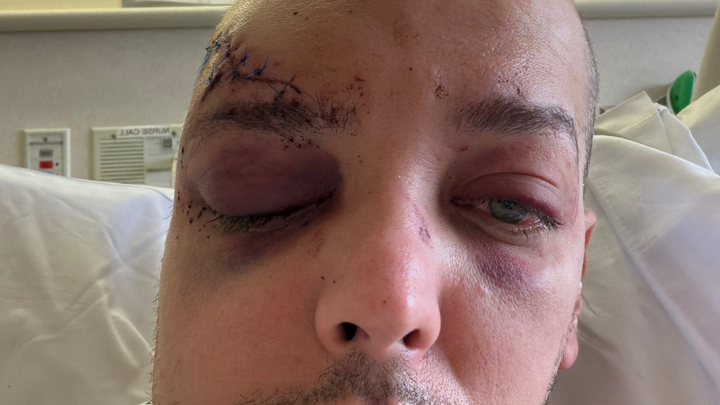 Help Chris (aka Seno) Bridge the Gap During Recovery campaign photo, 1 of 8