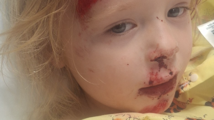 Support London Jones' Family After Accident campaign photo, 1 of 4