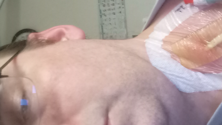 Support Benjamin's Fight Against Guillain-Barre campaign photo, 1 of 8