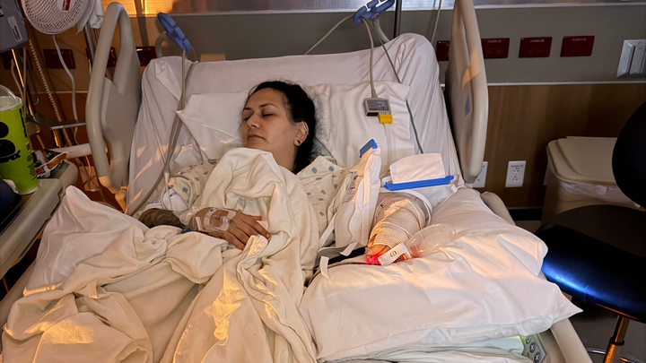 Support Recovery After Traumatic Arm Injury campaign photo, 1 of 6