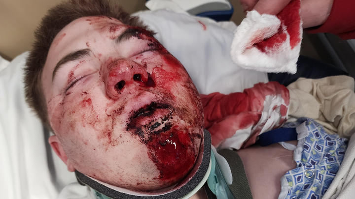 Help My Son Heal from His Severe Injuries campaign photo, 1 of 5