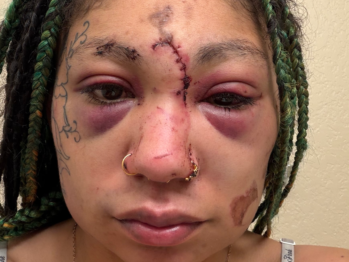 Survivor trying to survive campaign photo, 1 of 8