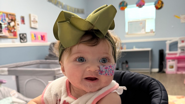 Support Millie’s Cleft Journey campaign photo, 1 of 6