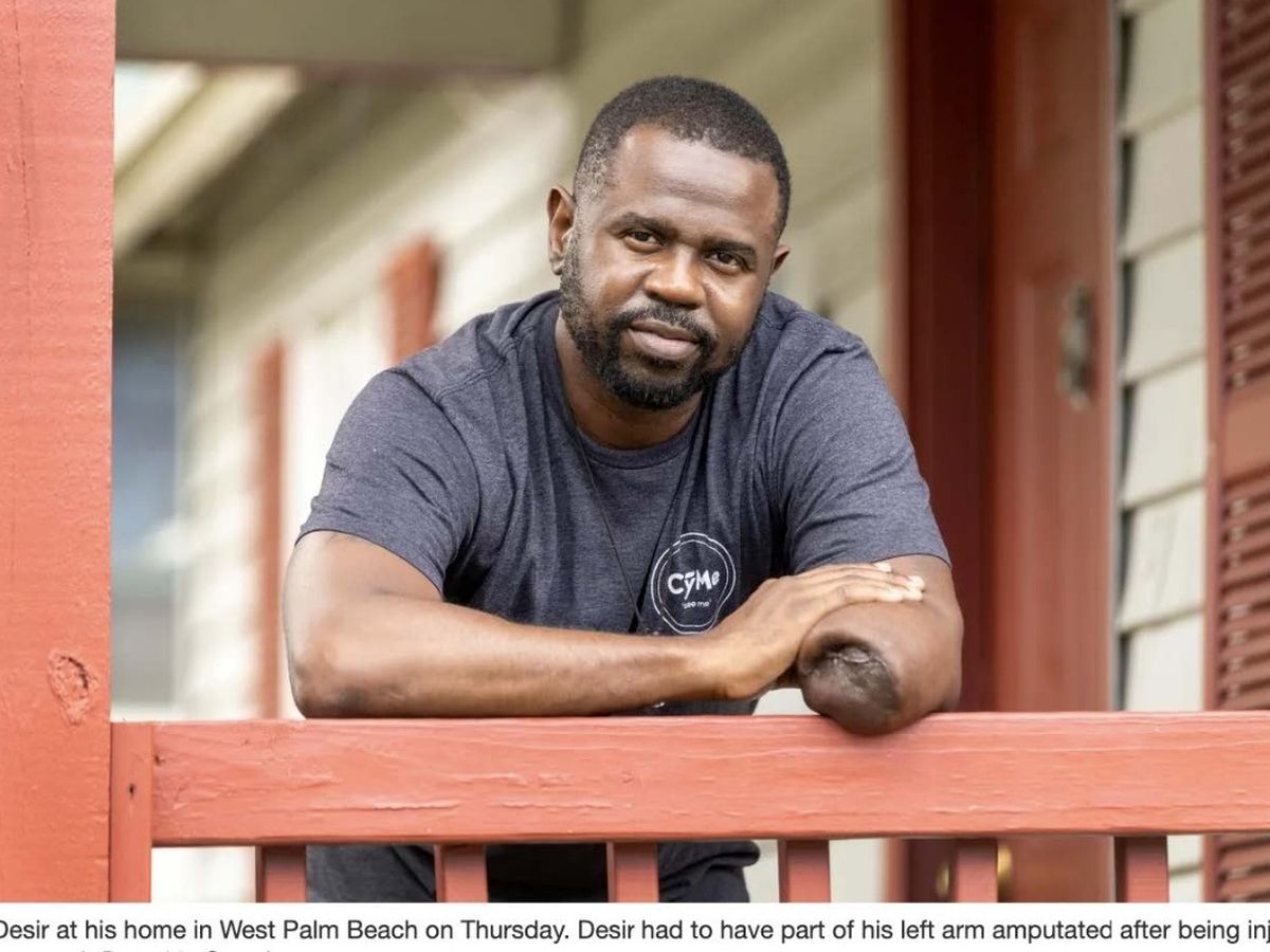 Fundraiser for Jeff Desir by Steven Sculler : Massage Therapist lost his  hand in car accident