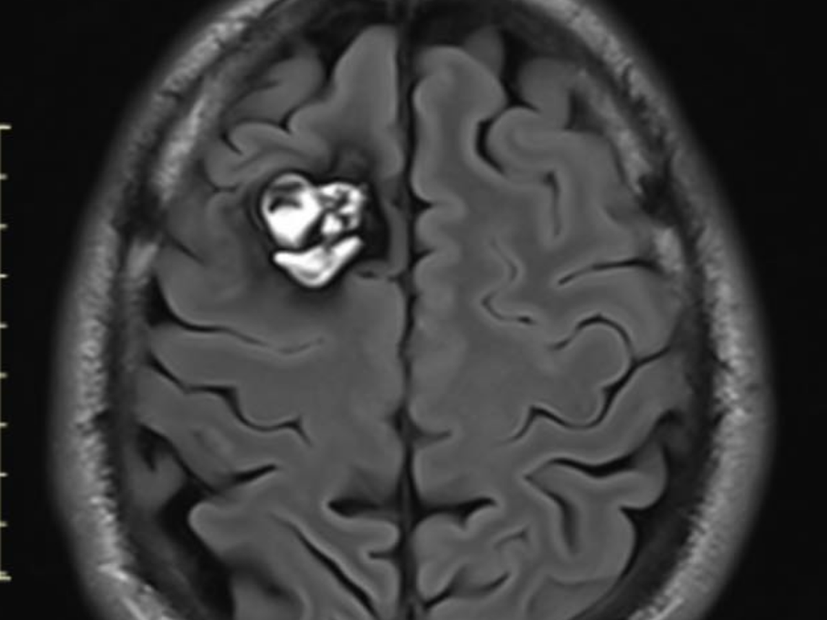 Fundraiser’s main image
