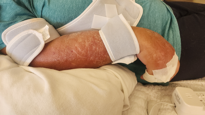Assist Mom's Recovery: Urgent Need campaign photo, 1 of 6
