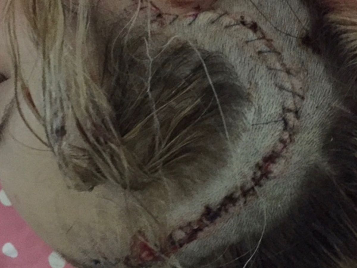 Fundraiser by Alana Grnja : Help Alana Fight Her 2nd Brain Tumor