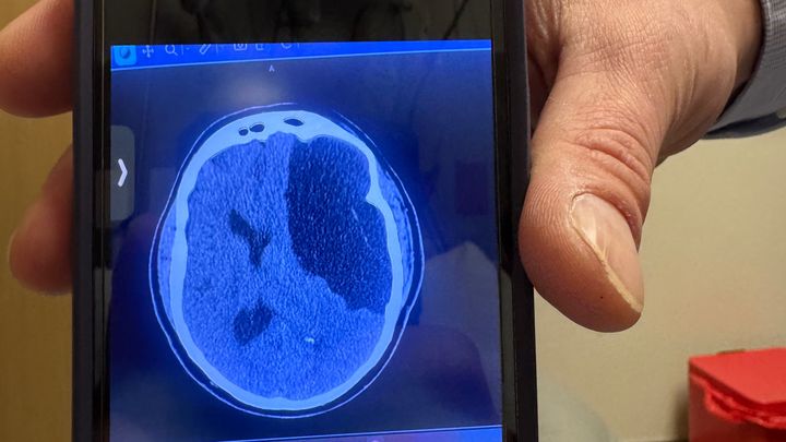 Support for Dad’s Recovery After Brain Surgery campaign photo, 1 of 5