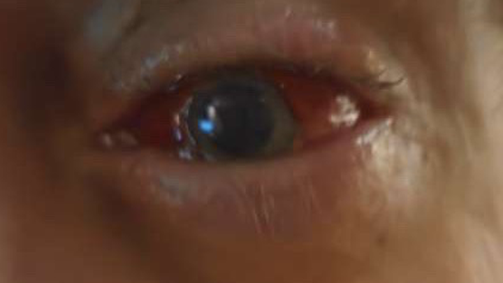 medical bills for an unexpected eye injury campaign photo, 1 of 7
