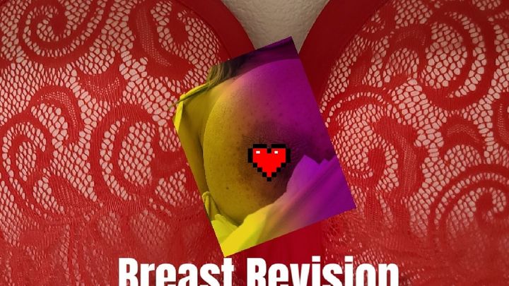 Fundraiser by Aiisha EGYPT Ferguson Breast Revision