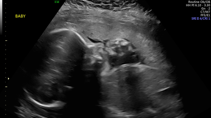 Aid for a Safe Hospital Stay and Healthy Baby campaign photo, 1 of 4