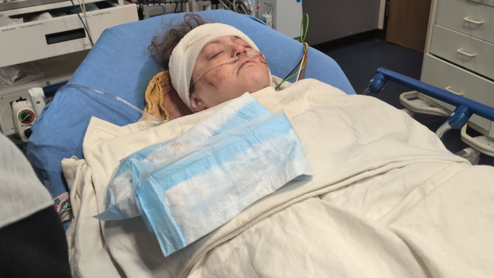 Help Amanda Kern during her recovery! campaign photo, 1 of 7