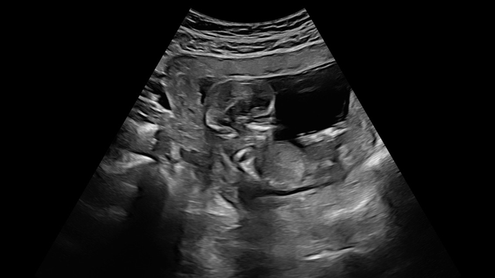 Prepare for Baby’s arrival❤️ campaign photo, 1 of 4
