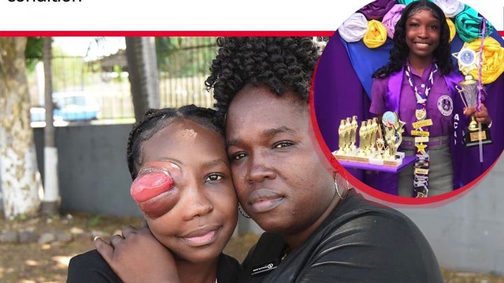 Help 16 Year Old Delayna Get Urgent Eye Surgery