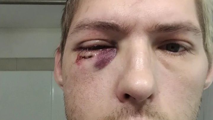 Help Me Recover from Injury campaign photo, 1 of 3