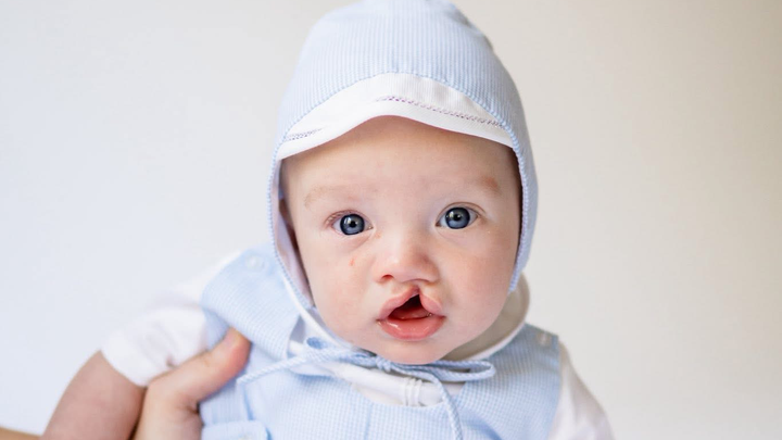 Help Banks Smile Even Bigger! campaign photo, 1 of 6